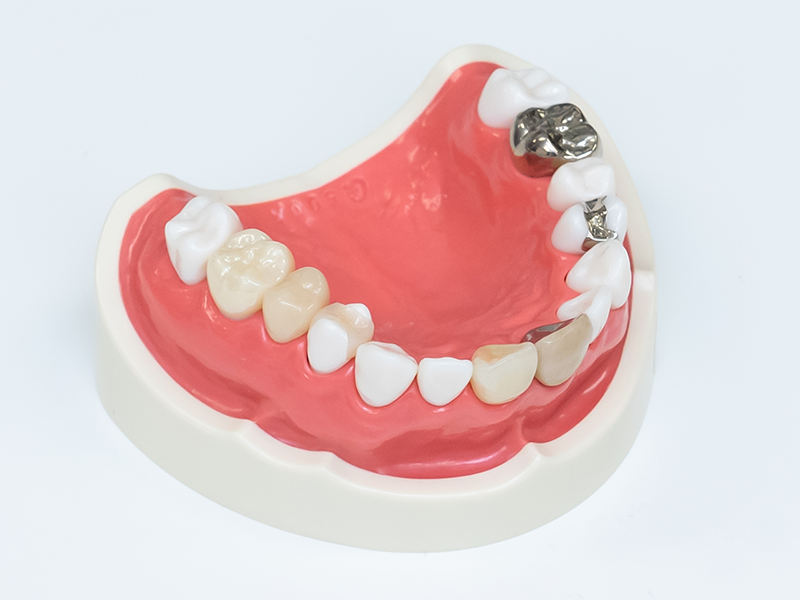 セラミック 見本