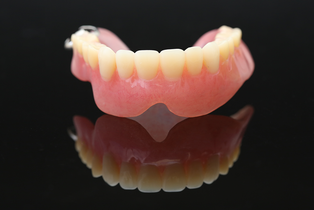 総入れ歯(総義歯)
