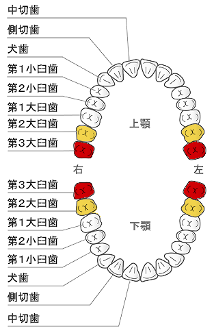 親知らずの位置を表した図